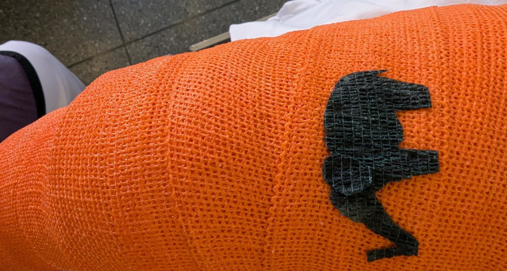 Gips på barn med lårbensfraktur